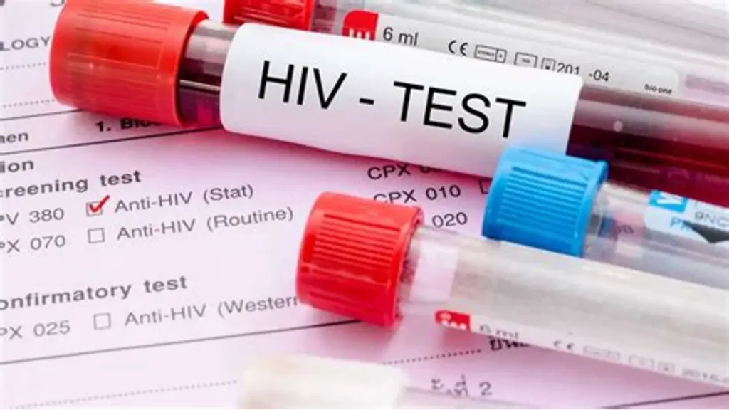 HIV Testing